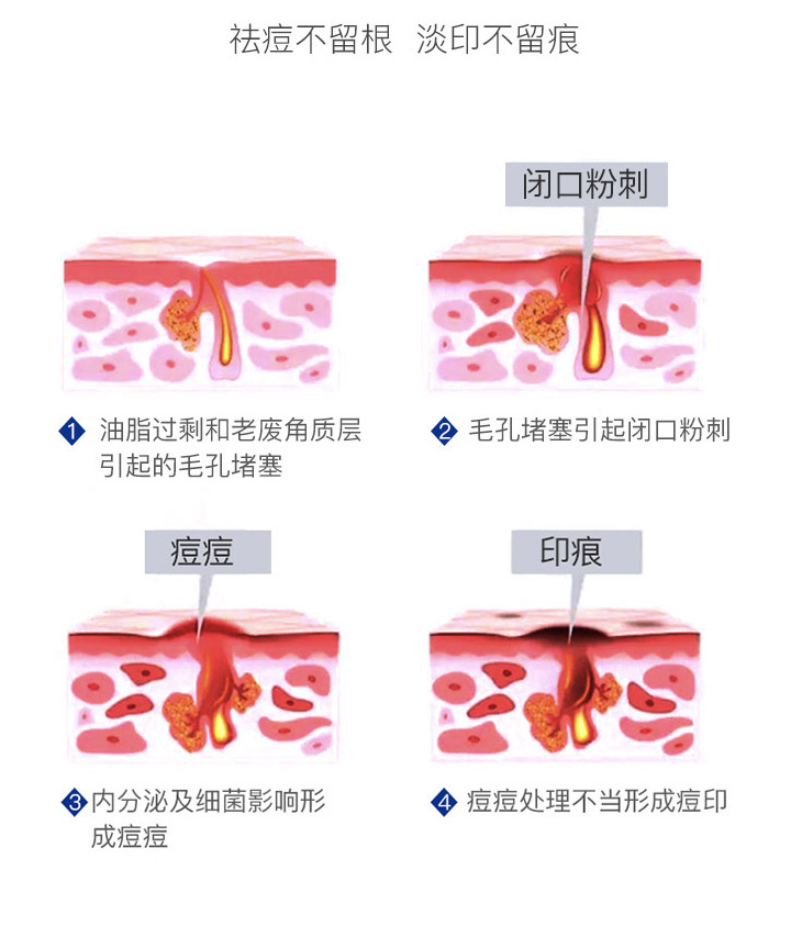 欧泉生化