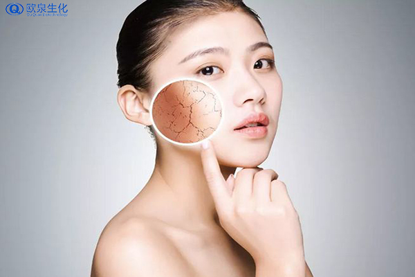 欧泉化妆品厂家教大家皮肤干皮护理-欧泉生化