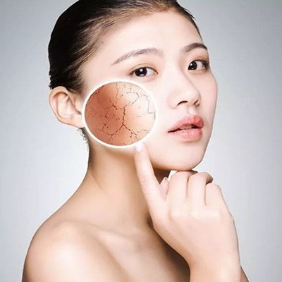 皮肤长斑与肌肤缺水有什么关联