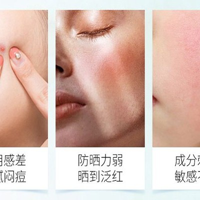 防晒oem厂家:防晒的重要性和误区