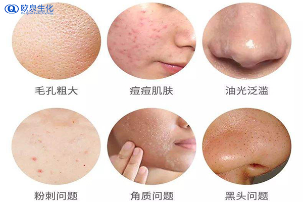 伤害皮肤的“元凶”竟然是自己-欧泉生化