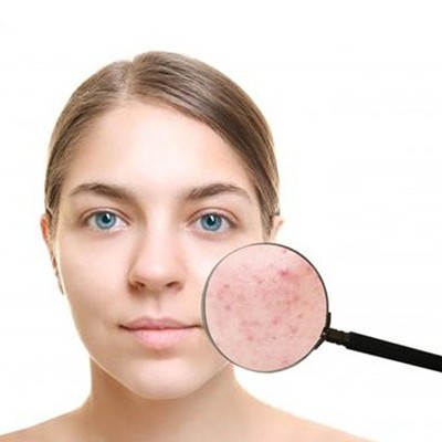 六种常见肤质的保养与皮肤护理