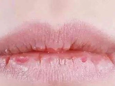 你知道怎么保护唇部吗？