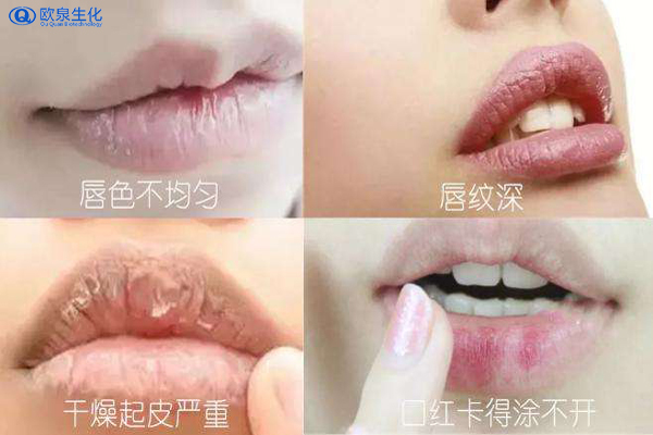 你知道怎么保护唇部吗-欧泉生化