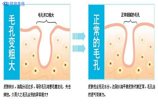常见毛孔堵塞的原因及疏通小窍门-欧泉生化