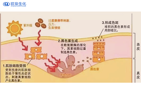 轩の蔻品牌祛斑产品用了会反弹吗-欧泉生化